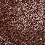 INO80E Antibody in Immunohistochemistry (Paraffin) (IHC (P))