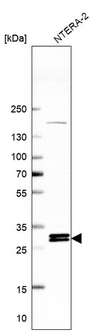INO80E Antibody in Western Blot (WB)