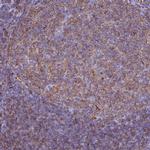 HLA-DRB1 Antibody in Immunohistochemistry (Paraffin) (IHC (P))
