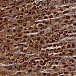 TMEM196 Antibody in Immunohistochemistry (Paraffin) (IHC (P))