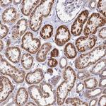 DOC2B Polyclonal Antibody