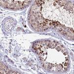 THAP5 Antibody in Immunohistochemistry (IHC)