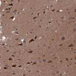 PDE12 Antibody in Immunohistochemistry (Paraffin) (IHC (P))