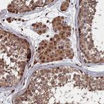 PDE12 Polyclonal Antibody