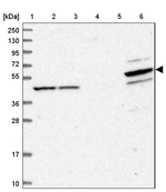PDE12 Antibody in Western Blot (WB)