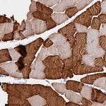 TNNC2 Antibody in Immunohistochemistry (IHC)