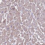 TNNC2 Antibody in Immunohistochemistry (IHC)