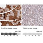 TNNC2 Antibody