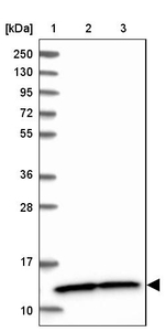 NDUFA5 Antibody in Western Blot (WB)
