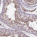 CNBD2 Antibody in Immunohistochemistry (Paraffin) (IHC (P))