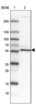 CNBD2 Antibody in Western Blot (WB)
