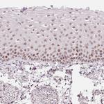 KLHDC9 Polyclonal Antibody