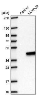 KLHDC9 Antibody in Western Blot (WB)