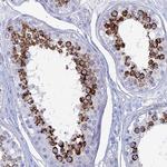 ALMS1 Antibody in Immunohistochemistry (Paraffin) (IHC (P))