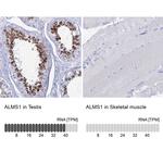ALMS1 Antibody in Immunohistochemistry (IHC)