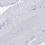 ALMS1 Antibody in Immunohistochemistry (IHC)