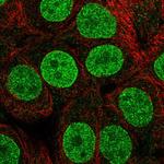 TETRAN Polyclonal Antibody