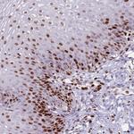 TETRAN Antibody in Immunohistochemistry (Paraffin) (IHC (P))
