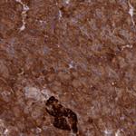 DDX60L Antibody in Immunohistochemistry (Paraffin) (IHC (P))