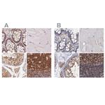 ANKRD13A Polyclonal Antibody