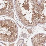 ANKRD13A Antibody in Immunohistochemistry (IHC)
