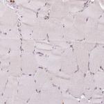 ANKRD13A Antibody in Immunohistochemistry (IHC)