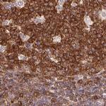 ANKRD13A Antibody in Immunohistochemistry (IHC)