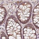 ANKRD13A Antibody in Immunohistochemistry (IHC)