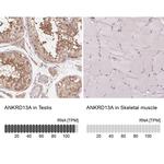 ANKRD13A Antibody