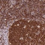 ANKRD13A Antibody in Immunohistochemistry (IHC)