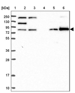 ANKRD13A Antibody in Western Blot (WB)
