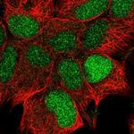 CCDC106 Polyclonal Antibody