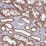 CCDC106 Antibody in Immunohistochemistry (Paraffin) (IHC (P))
