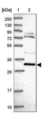 CCDC106 Antibody in Western Blot (WB)