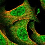 DDI2 Polyclonal Antibody