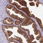 DDI2 Antibody in Immunohistochemistry (Paraffin) (IHC (P))