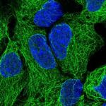 NEK3 Polyclonal Antibody