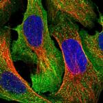 ARHGAP19 Polyclonal Antibody