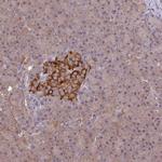 ARHGAP19 Antibody in Immunohistochemistry (Paraffin) (IHC (P))