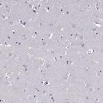 GAGE1 Antibody in Immunohistochemistry (Paraffin) (IHC (P))