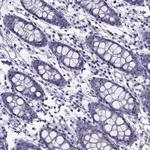 GAGE1 Antibody in Immunohistochemistry (Paraffin) (IHC (P))