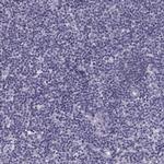 GAGE1 Polyclonal Antibody