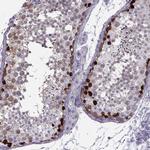 GAGE1 Antibody in Immunohistochemistry (IHC)