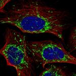 C5orf63 Polyclonal Antibody