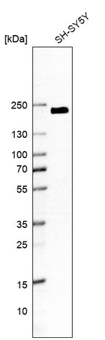KIAA1211 Antibody in Western Blot (WB)