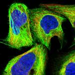 CCDC64B Polyclonal Antibody