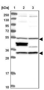 CCDC64B Antibody in Western Blot (WB)
