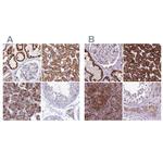 GCDH Antibody in Immunohistochemistry (IHC)