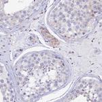 GCDH Antibody in Immunohistochemistry (IHC)