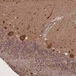 LIN37 Antibody in Immunohistochemistry (Paraffin) (IHC (P))